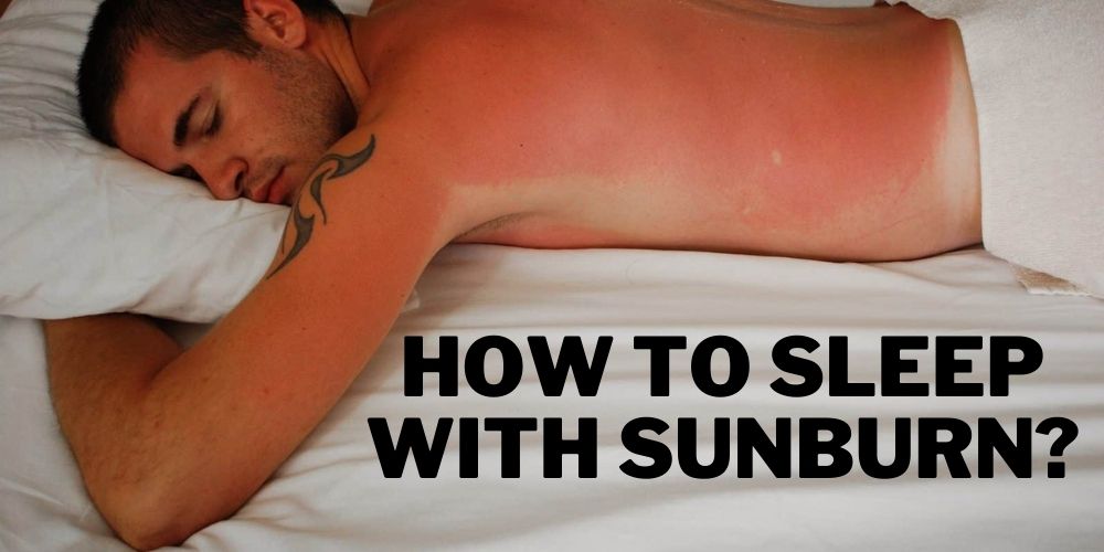 How to Sleep with Sunburn?